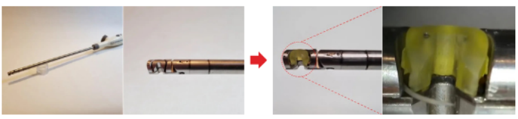 Micrometric Fabrication Empowers the Future of Minimally Invasive Surgery Micrometric Fabrication Empowers the Future of Minimally Invasive Surgery